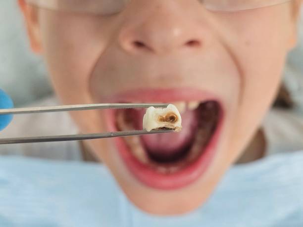 Best Emergency Dentist for Special Needs Patients in Huntley, IL