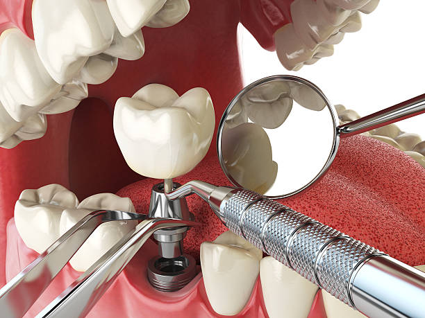 Best Weekend Emergency Dentist in Huntley, IL