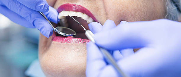 Best Urgent Dental Care for Toothache in Huntley, IL